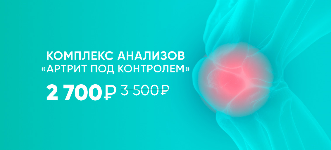 Скидка на комплекс анализов «Артрит под контролем»!